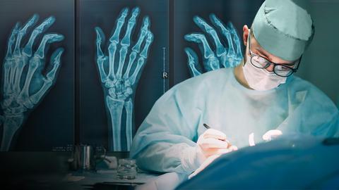 Handchirurg bei der Operation, links sind Röntgenbilder der Hand zu sehen. 